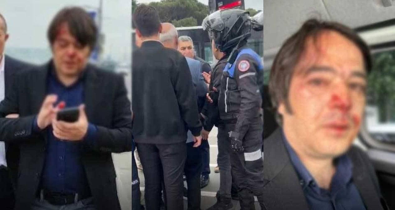 İBB İmar Müdürü'nün Kafeleri Yıkma Operasyonu: Saldırıya Maruz Kaldı